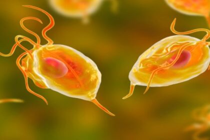 La tricomoniasis, una ETS común y subestimada