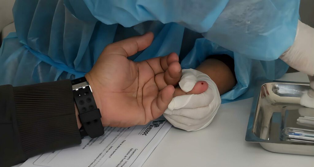 Convite denuncia escasez de pruebas del VIH en hospitales del país