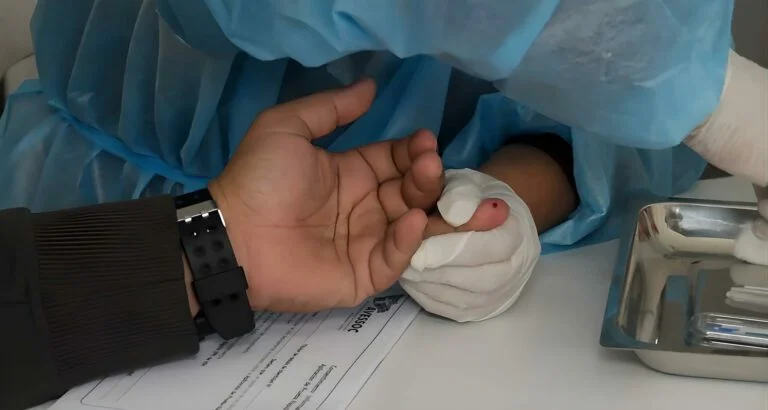 Convite denuncia escasez de pruebas del VIH en hospitales del país