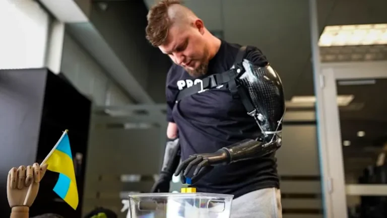 Prótesis hechas con biónica e inteligencia artificial ayudan a soldados ucranianos a recuperar movilidad