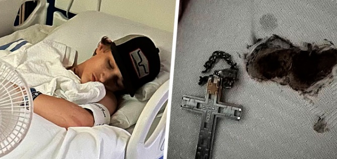 Adolescente en Estados Unidos casi muere electrocutado por su collar