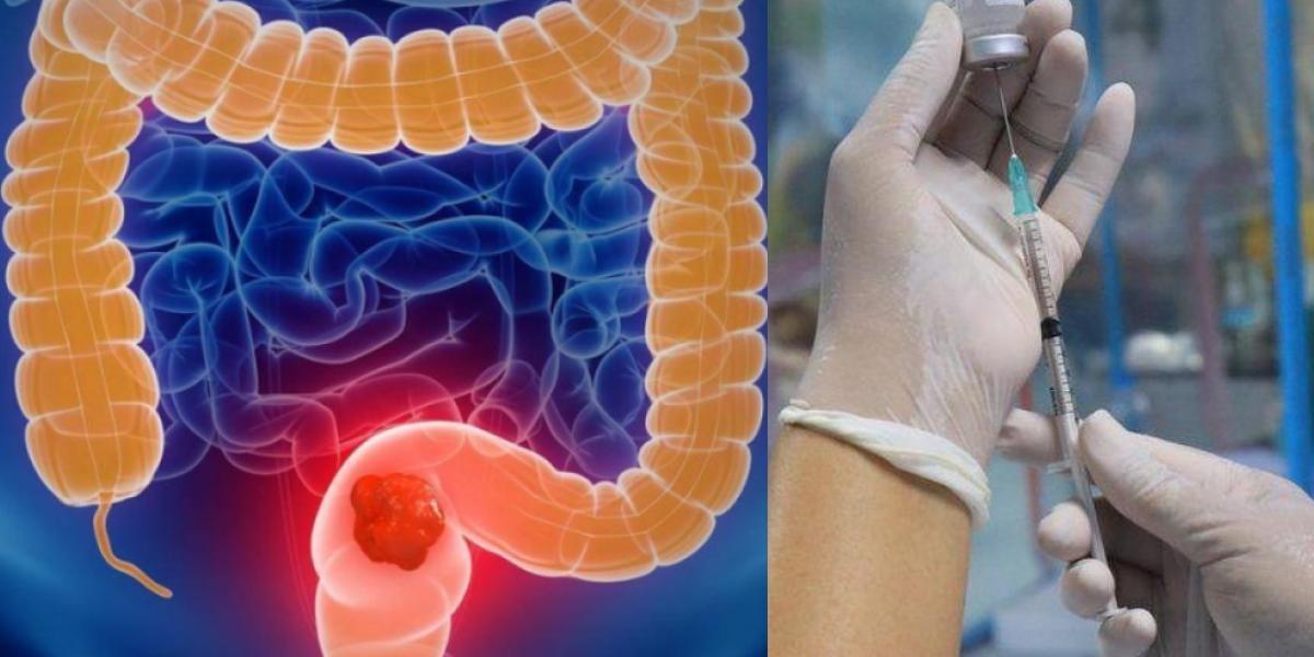 Inglaterra inicia pruebas de vacunas contra el cáncer de colón