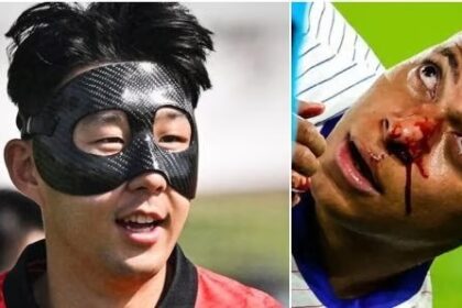 Kylian Mbappé jugará en la Eurocopa 2024 con una máscara de policarbonato