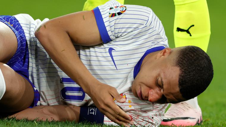 ¿Cuándo regresará Kylian Mbappé tras la fractura en la nariz?