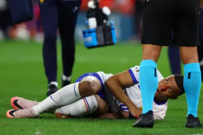 Kylian Mbappé enfrenta cirugía urgente por fractura en la nariz