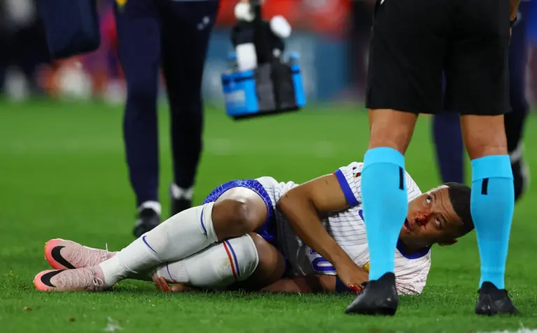 Kylian Mbappé enfrenta cirugía urgente por fractura en la nariz