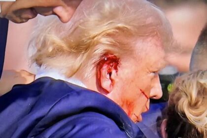 Trump confirmó que la bala hirió la parte superior de su oreja derecha