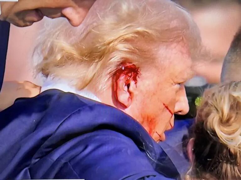 Trump confirmó que la bala hirió la parte superior de su oreja derecha