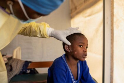 Primer caso de mpox en Pakistán activa alarmas globales
