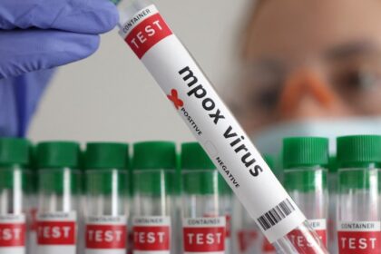 Alemania confirma un caso de la nueva variante de mpox en un viajero