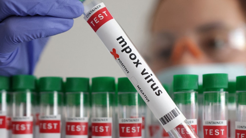 Alemania confirma un caso de la nueva variante de mpox en un viajero