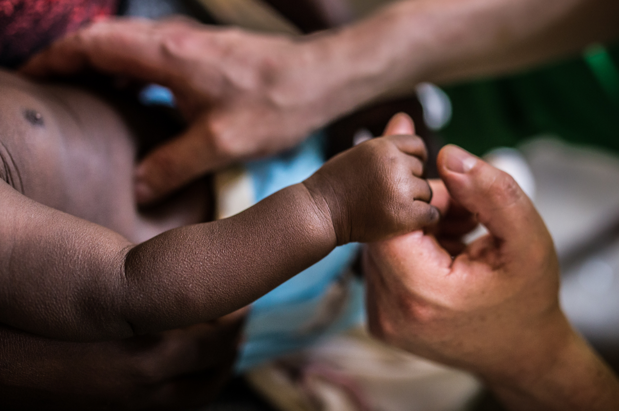Venezuela reporta primer caso de polio tras 30 años de erradicación