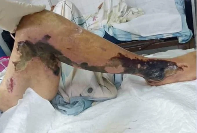 Fallece preso político por negligencia médica en Anzoátegui