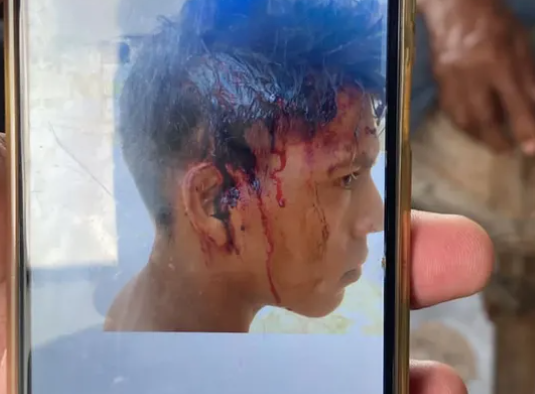 Grupo armado secuestra y agrede brutalmente a trabajadores en finca de Machiques de Perijá