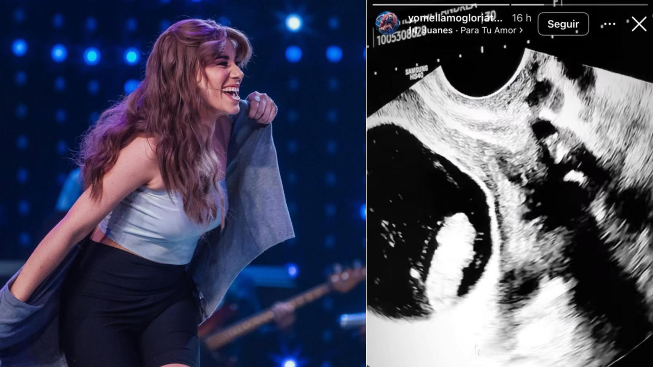 ¡Bebé en camino! Imitadores de Luis Alfonso y Gloria Trevi de ‘Yo Me Llamo’ 2025 anuncian la llegada de su primer hijo ¡Bebé en camino! Imitadores de Luis Alfonso y Gloria Trevi de ‘Yo Me Llamo’ 2025 anuncian la llegada de su primer hijo