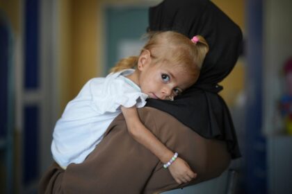 Niña con una enfermedad rara evacuada de Gaza se recupera de desnutrición en un hospital italiano