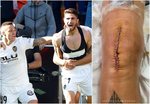 Cristiano Piccini se retira: “Verás contratos desvanecerse; tu rodilla derecha te hará conocer el infierno”