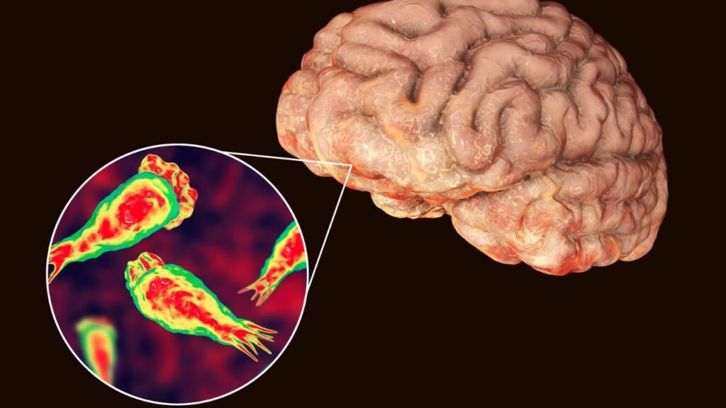 Ilustración de la ameba comecerebros Naegleria fowleri junto a un cerebro humano